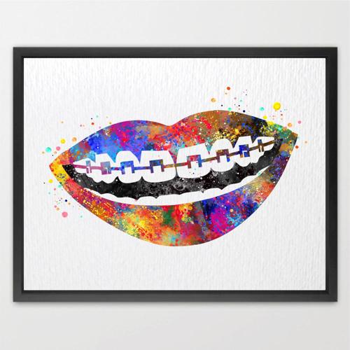 Dignovel Studios Unframed Tooth Braces Dentist Dentistry Dental Art Implant Orthodontics Orthodontist Science Watercolor Art Print Wall Art Poster Home Decor Hanging DN776