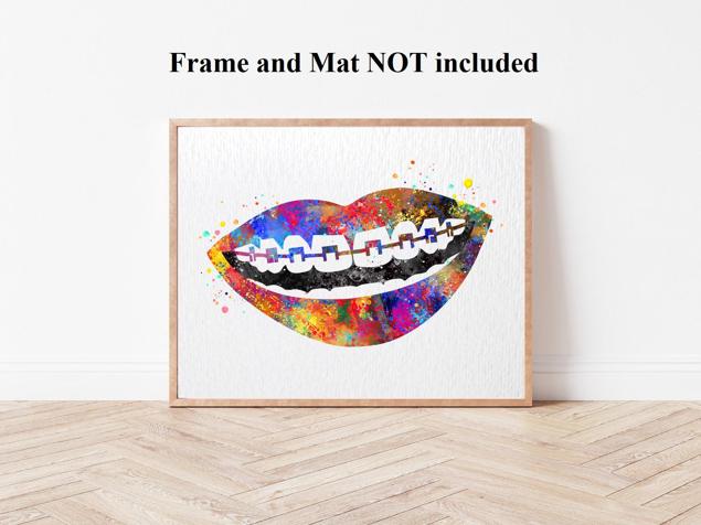 Dignovel Studios Unframed Tooth Braces Dentist Dentistry Dental Art Implant Orthodontics Orthodontist Science Watercolor Art Print Wall Art Poster Home Decor Hanging DN776 - Image 4