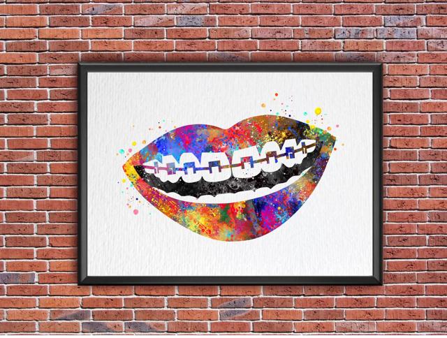 Dignovel Studios Unframed Tooth Braces Dentist Dentistry Dental Art Implant Orthodontics Orthodontist Science Watercolor Art Print Wall Art Poster Home Decor Hanging DN776 - Image 7